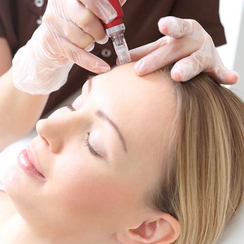 Mesotheraphy by Raderm